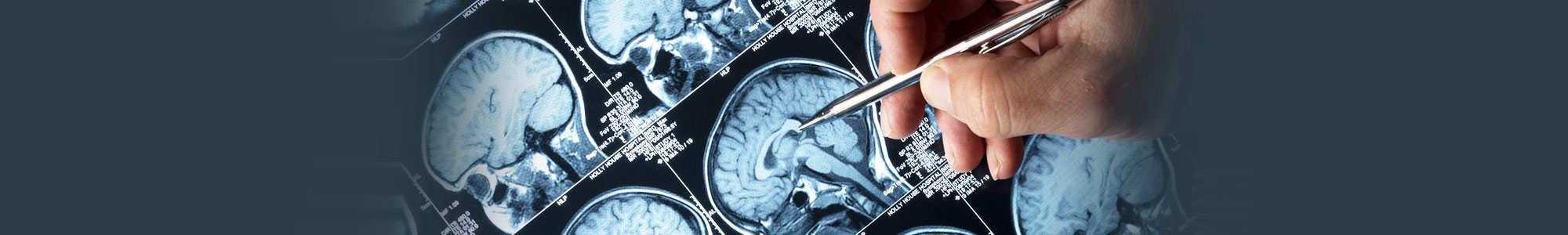 Brain Cancer